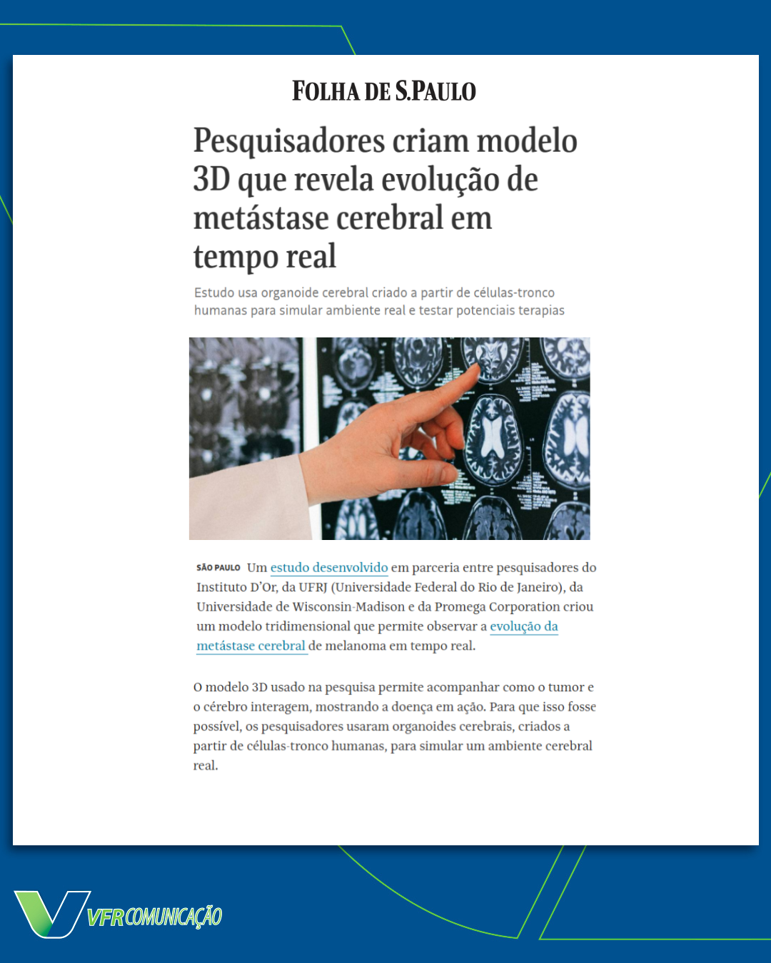 Instituto D´Or na Folha de S.Paulo